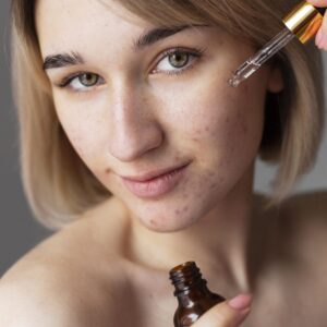 Anti Acne Face Serum - Credence Skincare